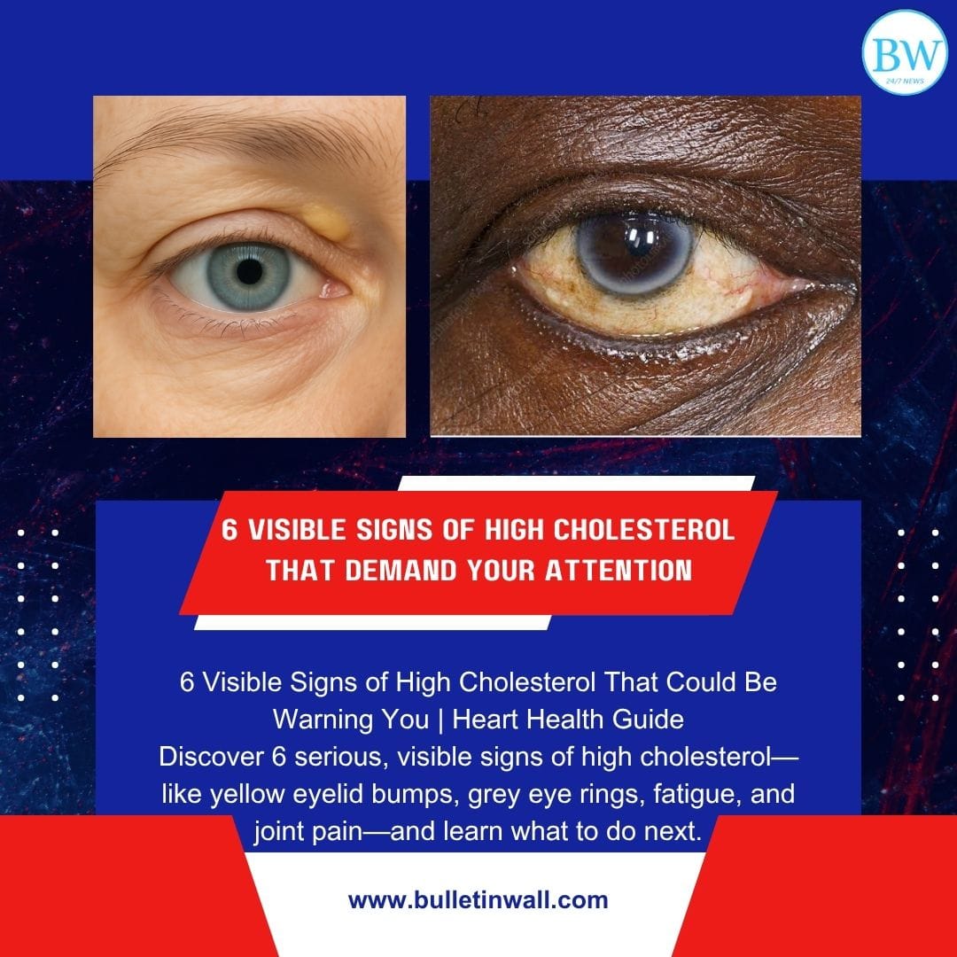 visible signs of high cholesterol